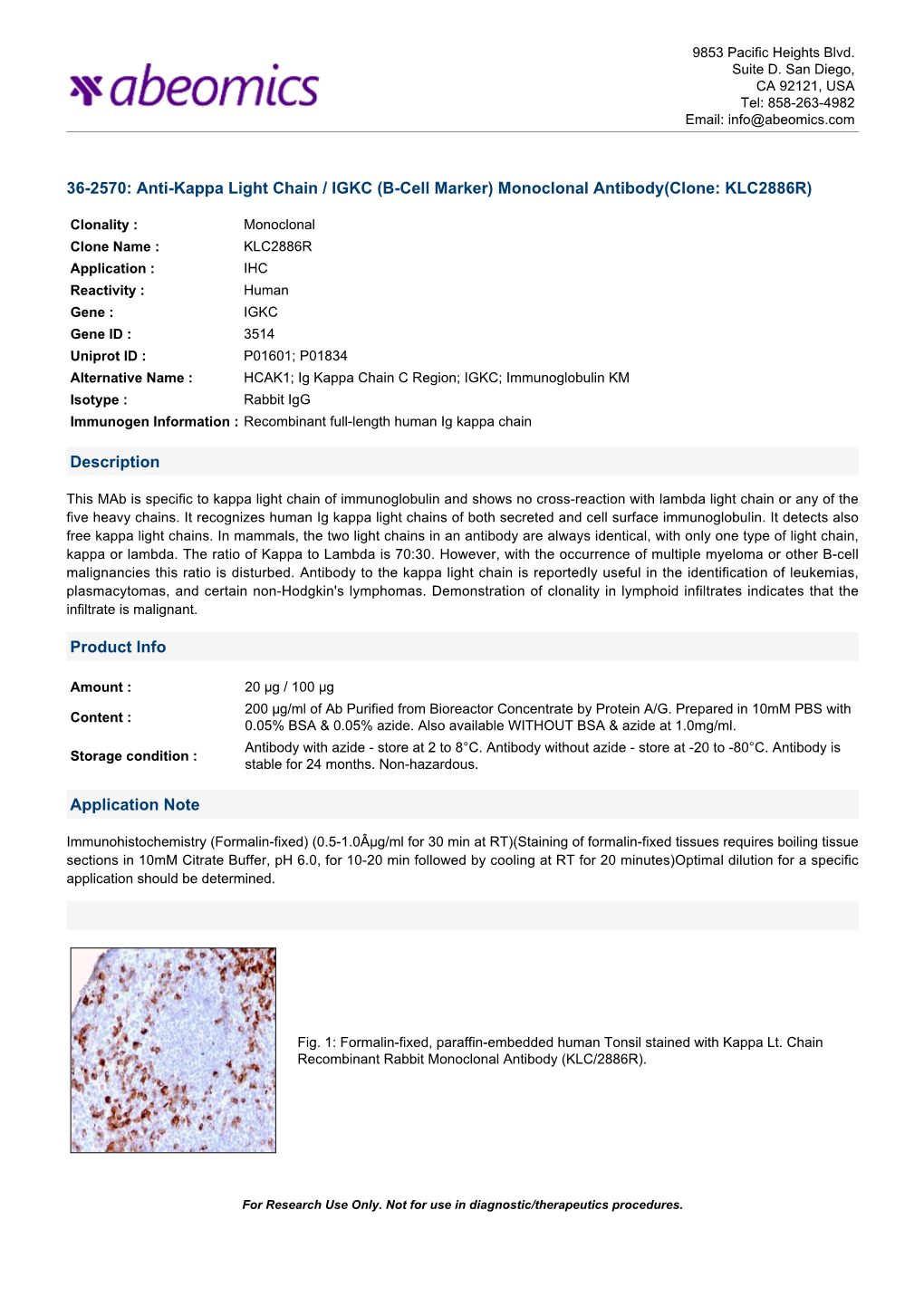 Anti-Kappa Light Chain / IGKC (B-Cell Marker) Monoclonal Antibody(Clone: KLC2886R)