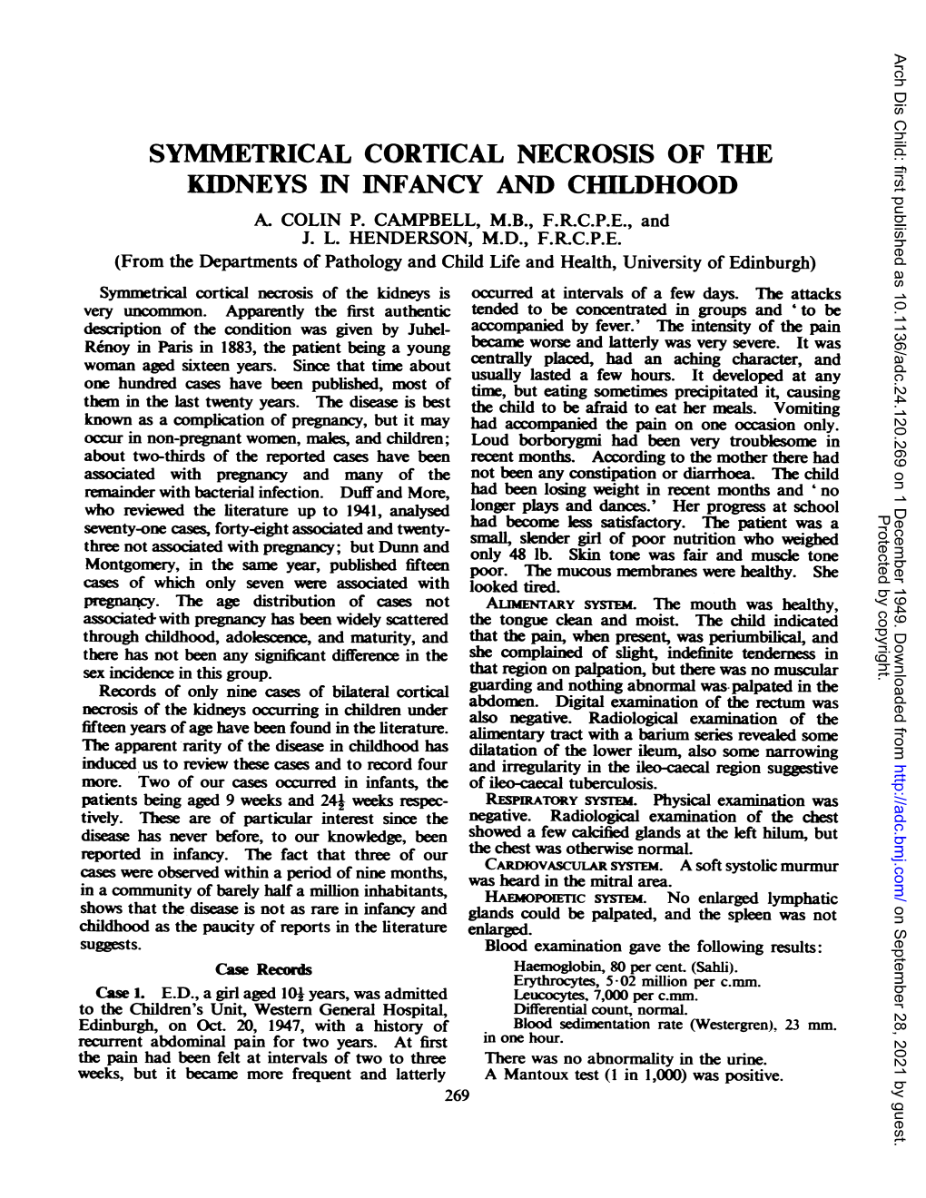 Symmetrical Cortical Necrosis of the Kidneys in Infancy and Childhood A