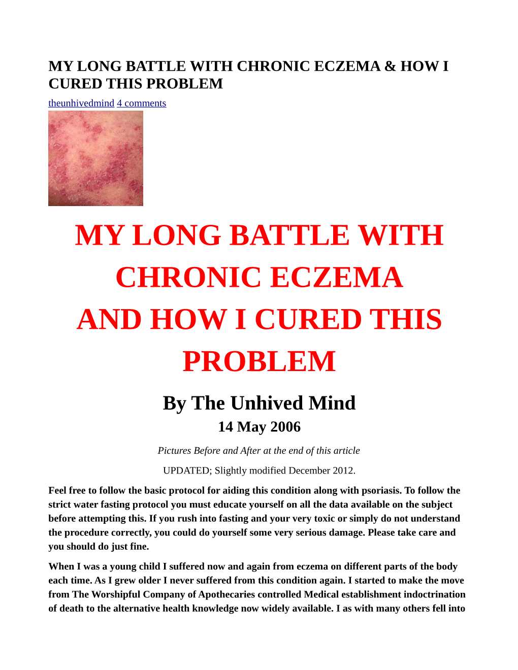 MY LONG BATTLE with CHRONIC ECZEMA and HOW I CURED THIS PROBLEM by the Unhived Mind 14 May 2006