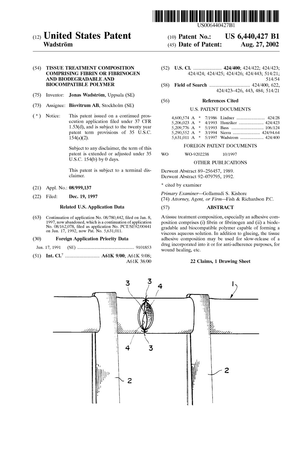 (12) United States Patent (10) Patent No.: US 6,440,427 B1 Wadström (45) Date of Patent: Aug