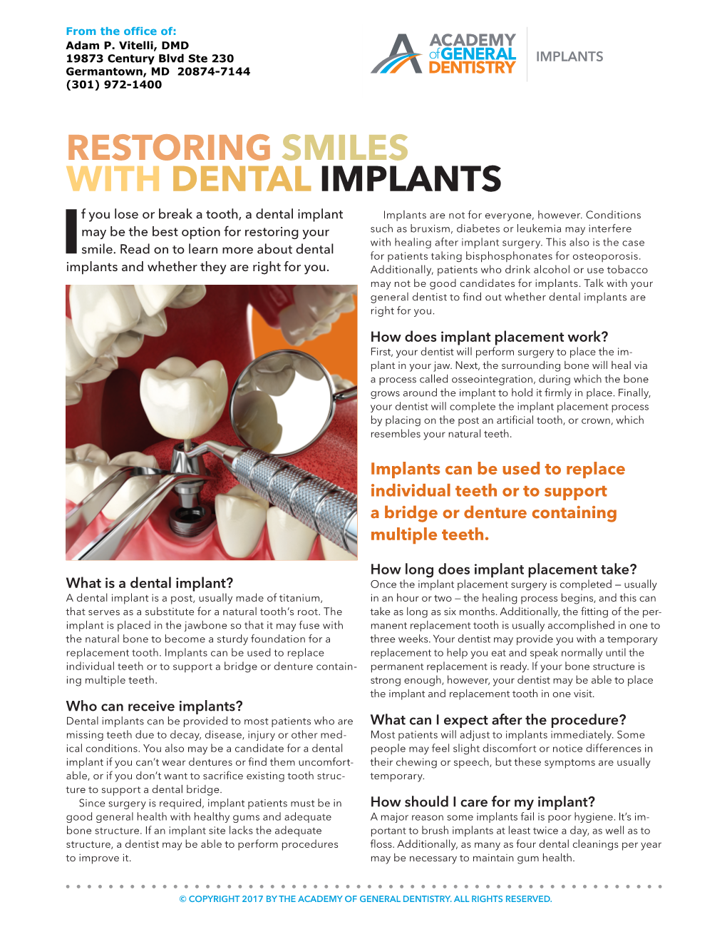 RESTORING SMILES with DENTAL IMPLANTS F You Lose Or Break a Tooth, a Dental Implant Implants Are Not for Everyone, However