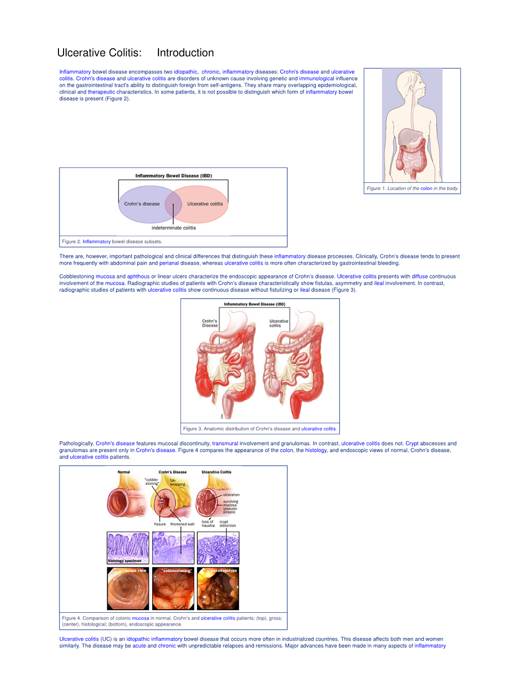 Ulcerative Colitis: Introduction