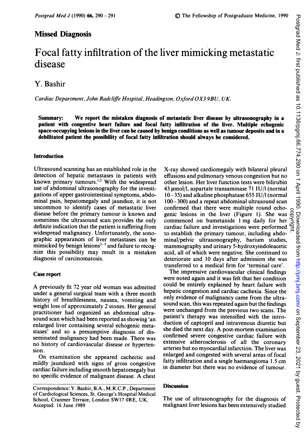 Focal Fatty Infiltration of the Liver Mimicking Metastatic Disease