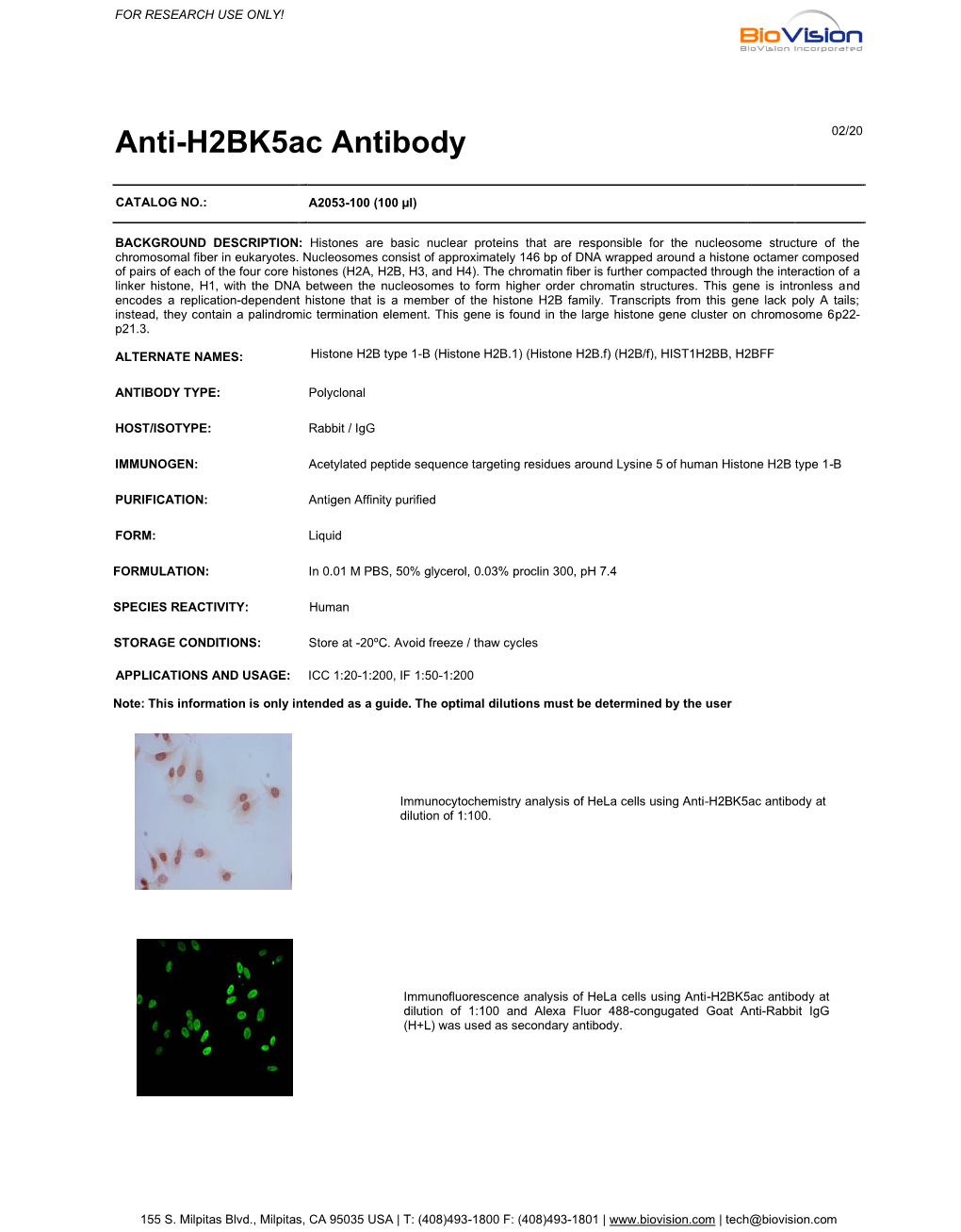Anti-H2bk5ac Antibody