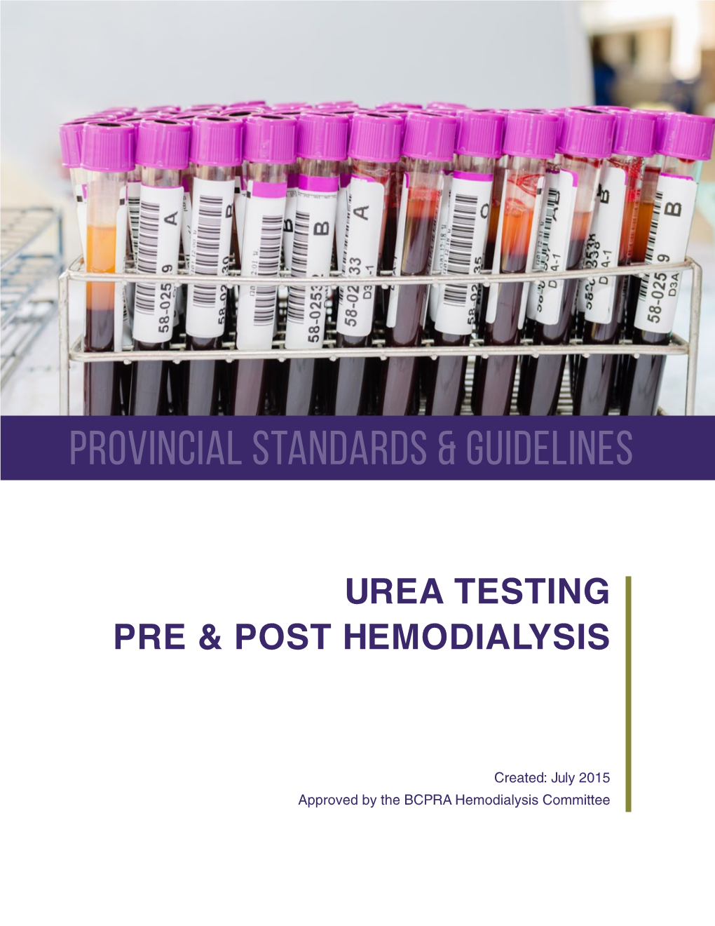 Urea Testing Pre & Post Hemodialysis