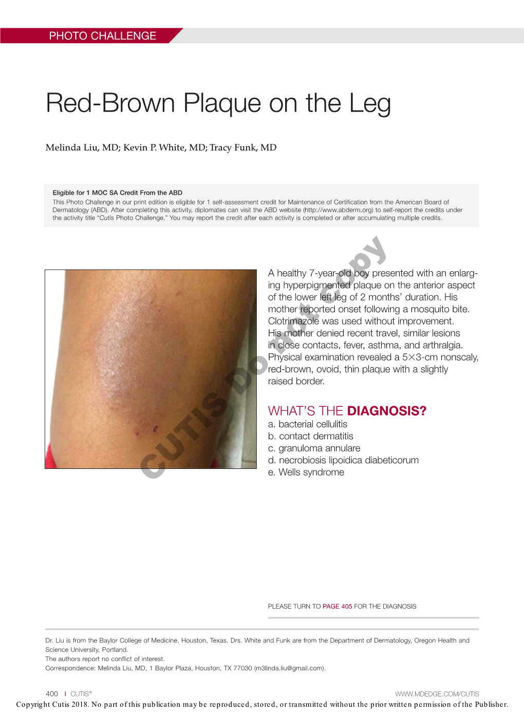 Red-Brown Plaque on the Leg