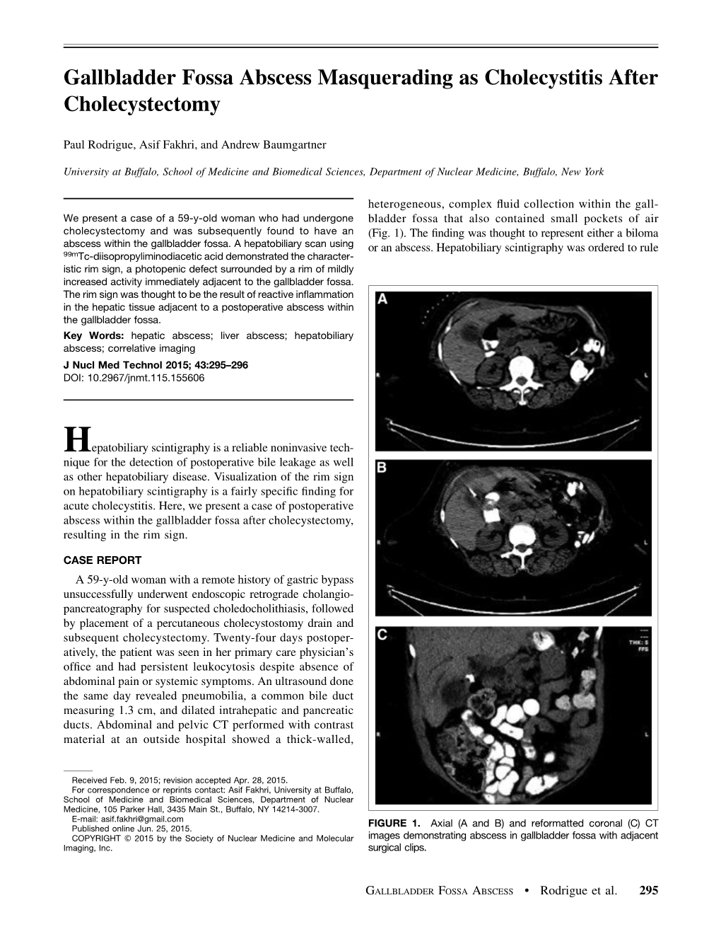 Gallbladder Fossa Abscess Masquerading As Cholecystitis After Cholecystectomy