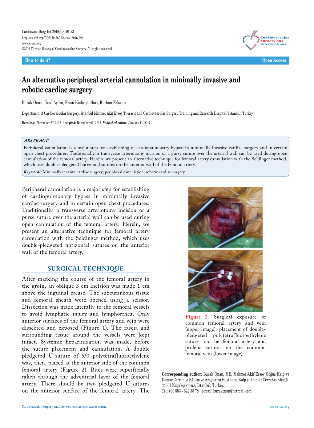 An Alternative Peripheral Arterial Cannulation in Minimally Invasive and Robotic Cardiac Surgery