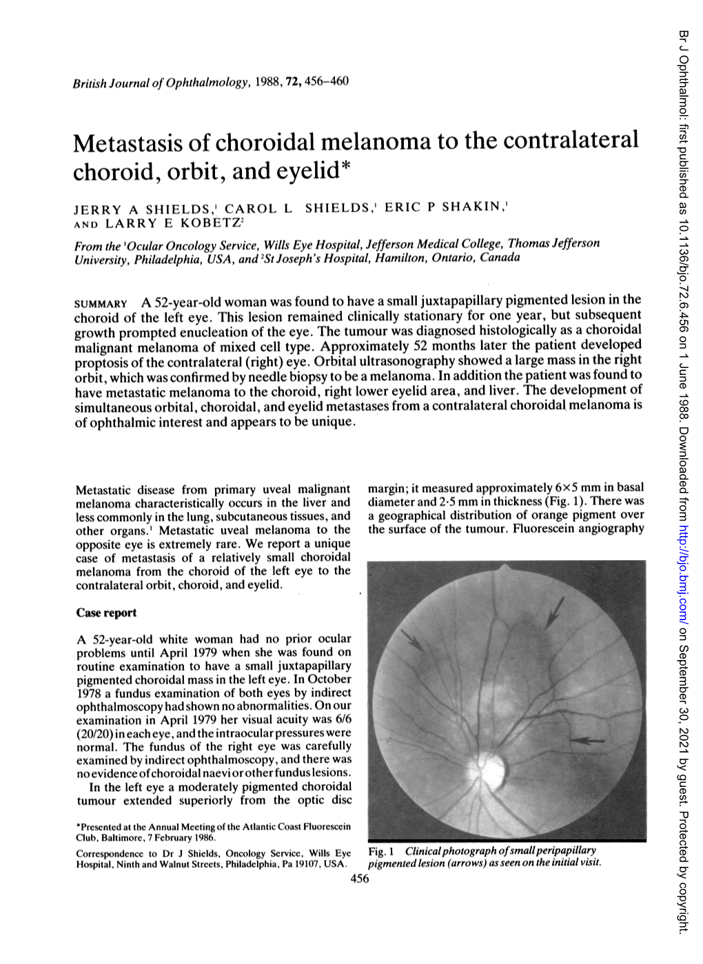 Choroid, Orbit, and Eyelid*