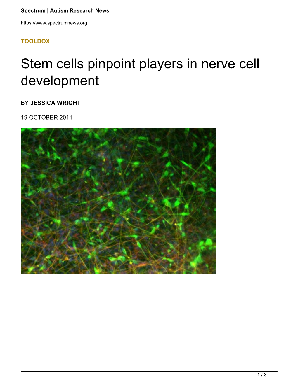 Stem Cells Pinpoint Players in Nerve Cell Development