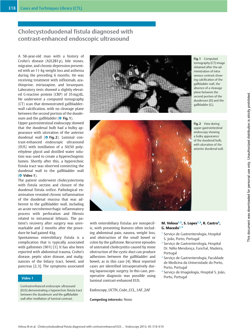 Cholecystoduodenal Fistula Diagnosed with Contrast-Enhanced Endoscopic Ultrasound