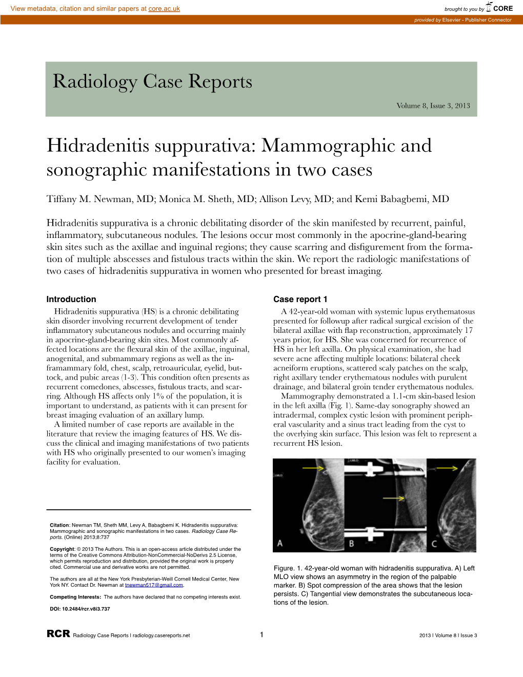 Hidradenitis Suppurativa: Mammographic and Sonographic Manifestations in Two Cases
