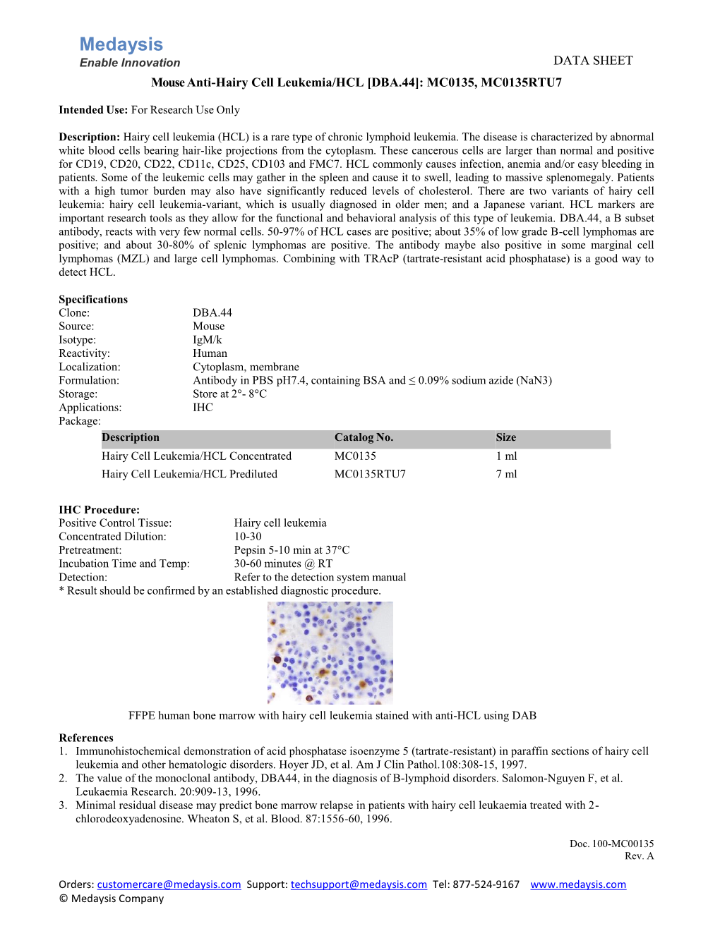 Hairy Cell Leukemia/HCL [DBA.44]: MC0135, MC0135RTU7
