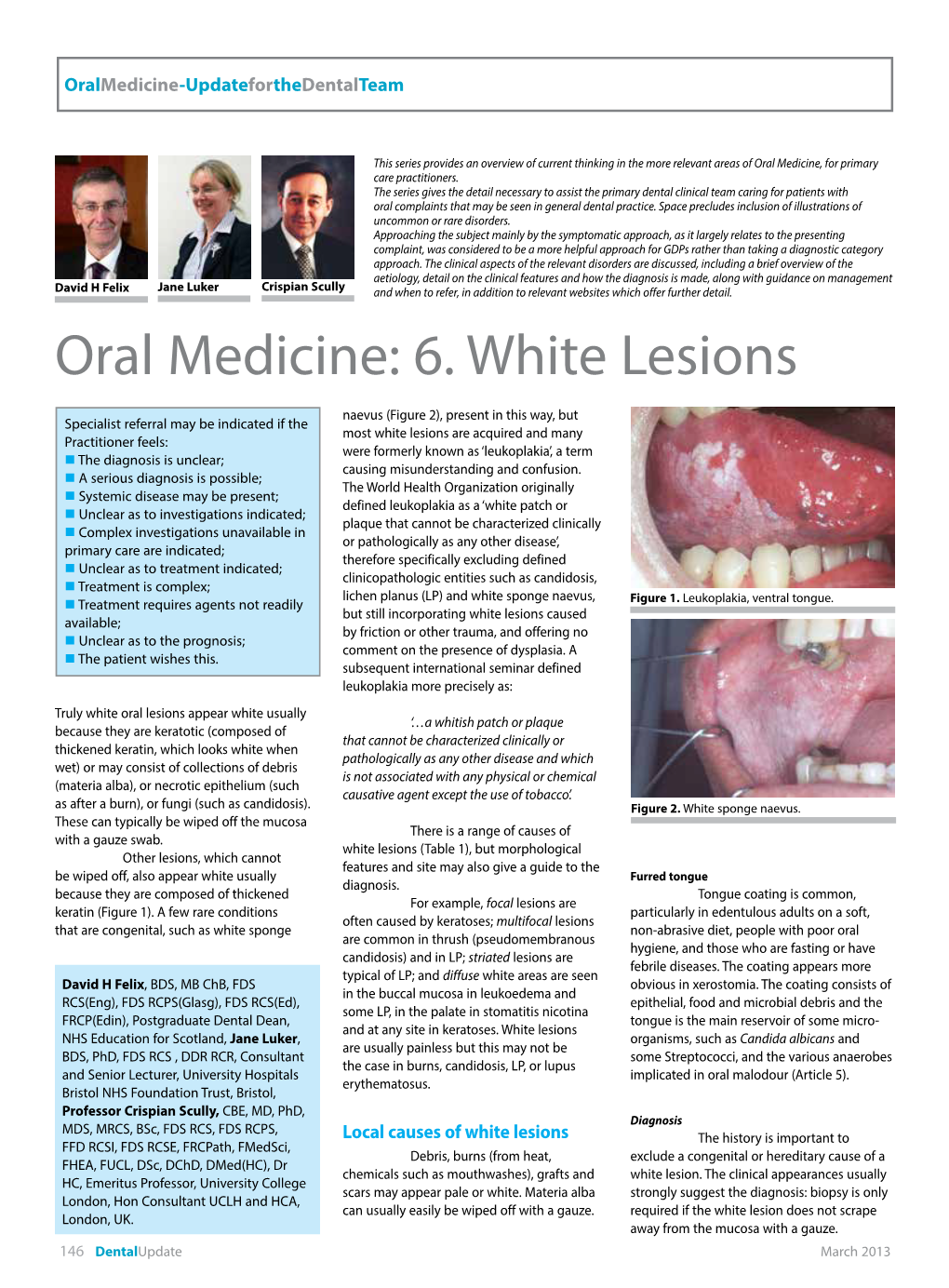 Oral Medicine: 6. White Lesions