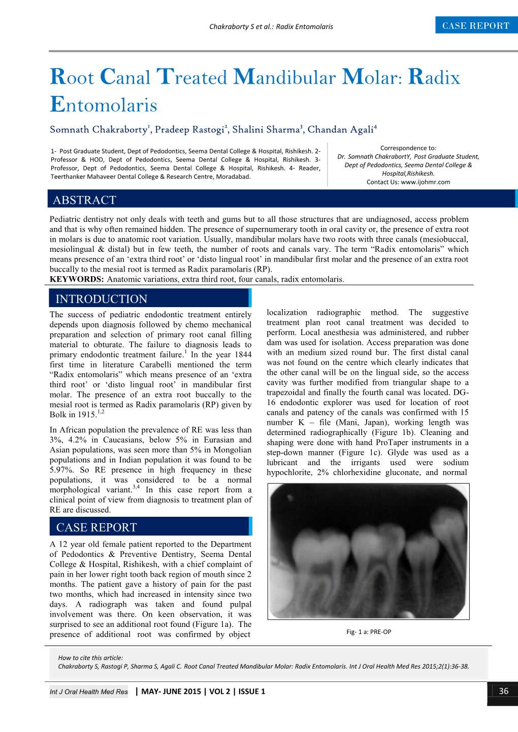 Root Canal Treated Mandibular Molar: Radix Entomolaris Somnath Chakraborty1, Pradeep Rastogi2, Shalini Sharma3, Chandan Agali4