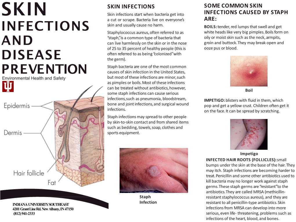 Skin Infections and Disease Prevention