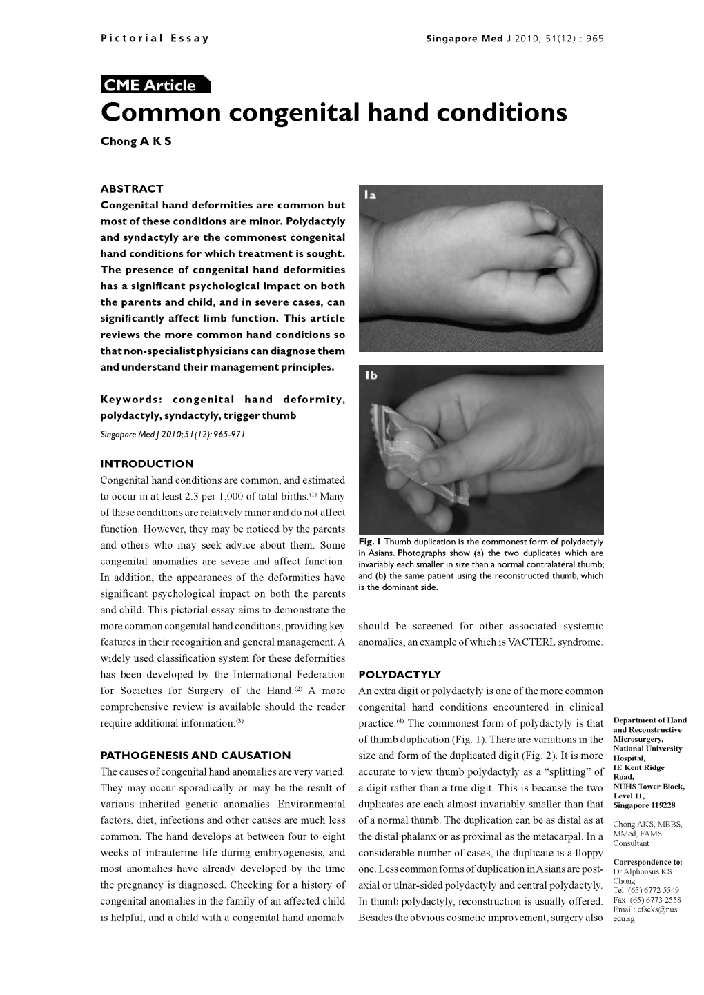 Common Congenital Hand Conditions