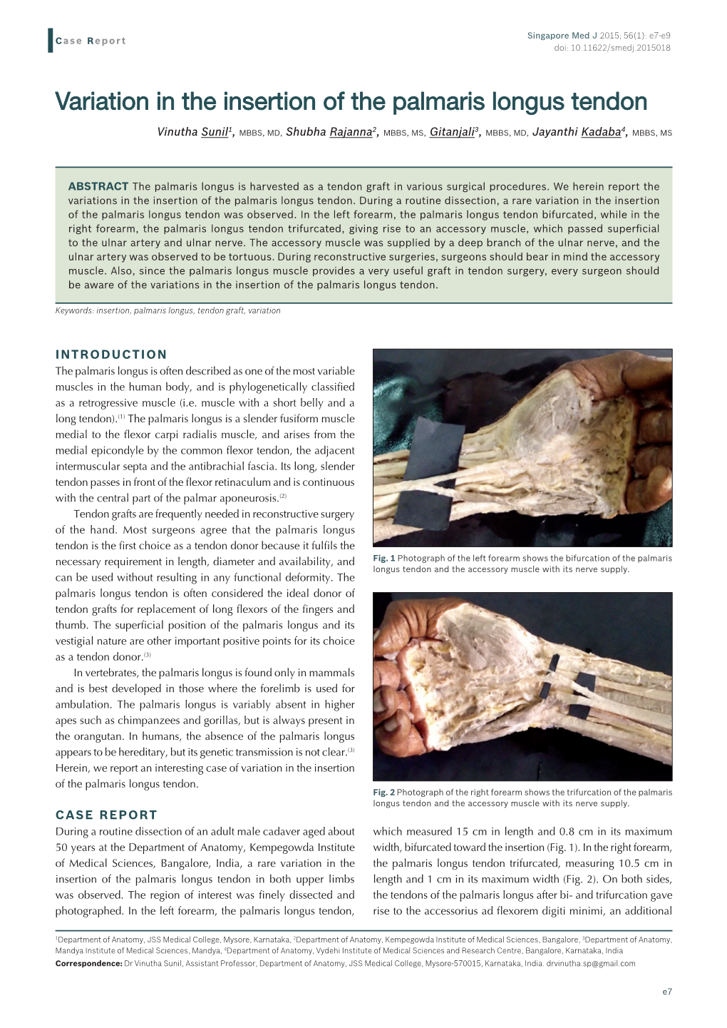 Variation in the Insertion of the Palmaris Longus Tendon