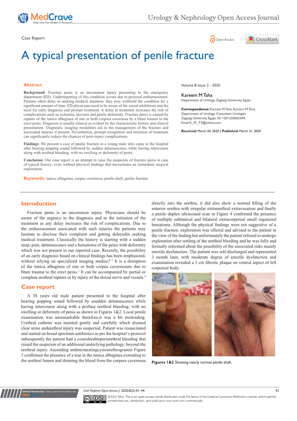 Atypical Presentation of Penile Fracture