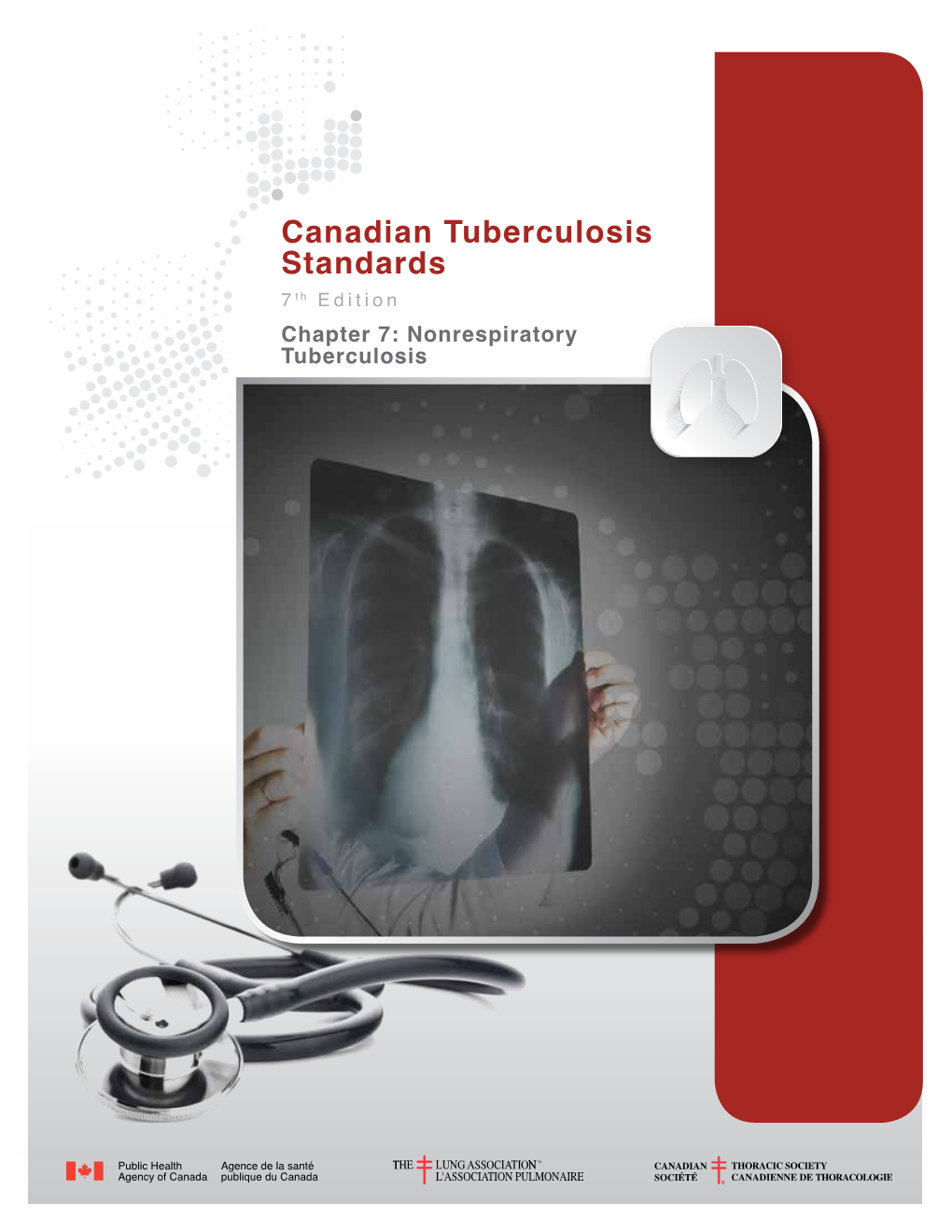 Canadian Tuberculosis Standards 7 Th Edition Chapter 7: Nonrespiratory Tuberculosis