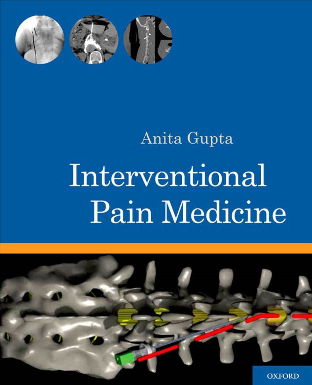 Interventional Pain Medicine This Page Intentionally Left Blank Interventional Pain Medicine