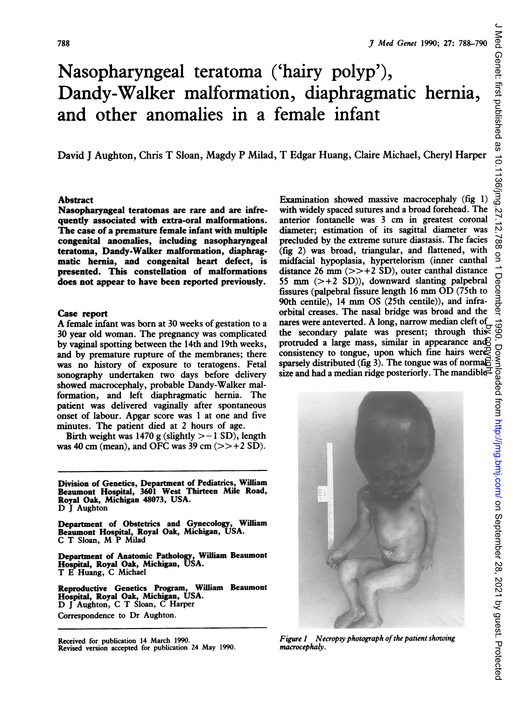 Nasopharyngeal Teratoma ('Hairy Polyp'), Dandy-Walker Malformation, Diaphragmatic Hernia, and Other Anomalies in a Female Infant