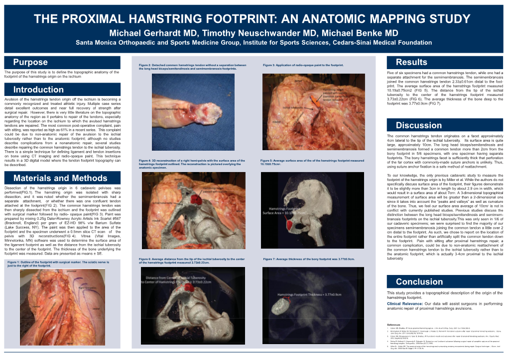 Proximal Hamstring Footprint