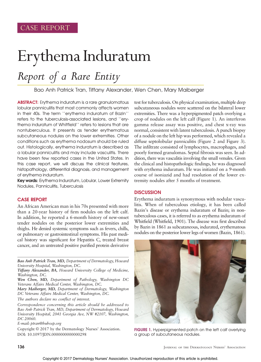 Erythema Induratum Report of a Rare Entity Bao Anh Patrick Tran, Tiffany Alexander, Wen Chen, Mary Maiberger