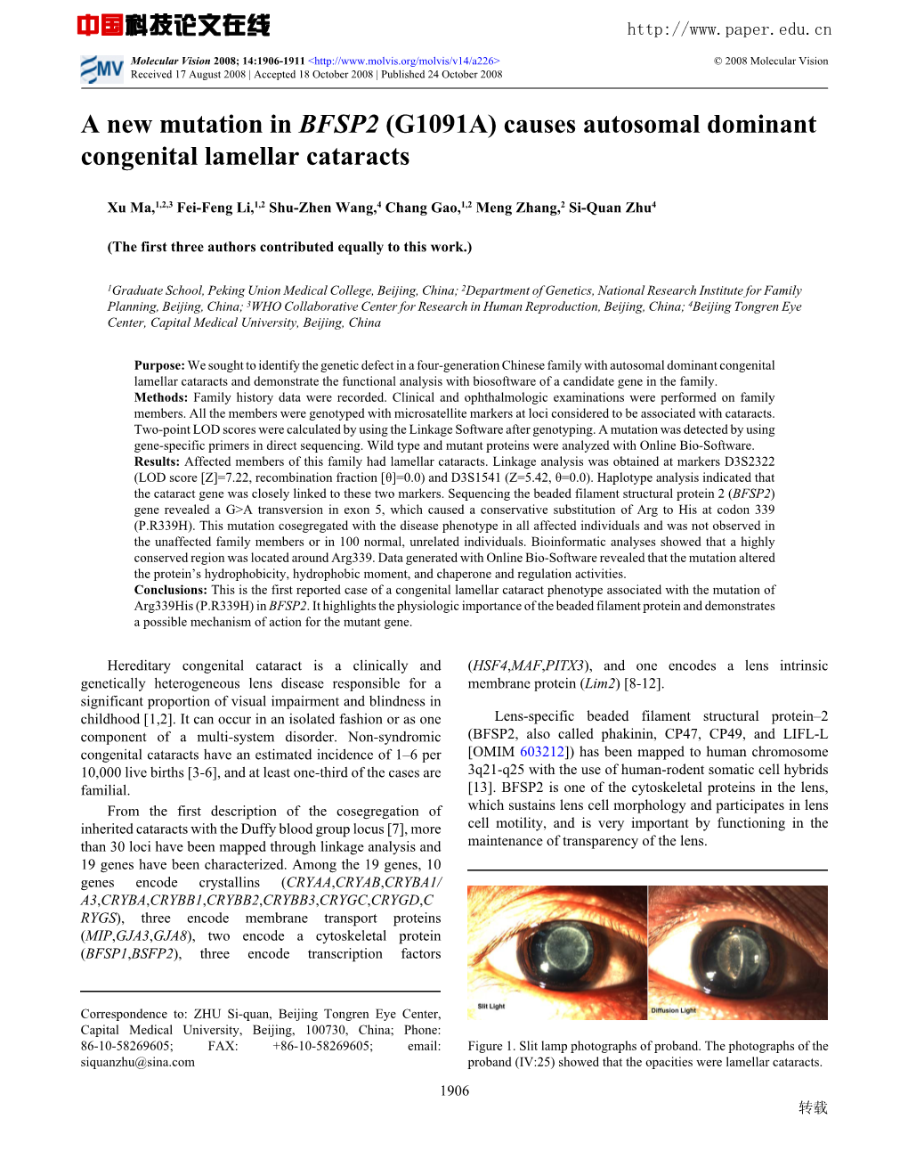 A New Mutation in BFSP2 (G1091A) Causes Autosomal Dominant Congenital Lamellar Cataracts