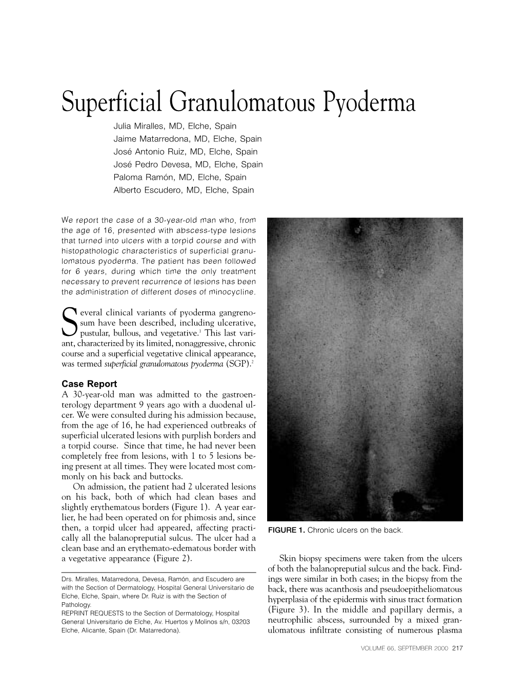 Superficial Granulomatous Pyoderma
