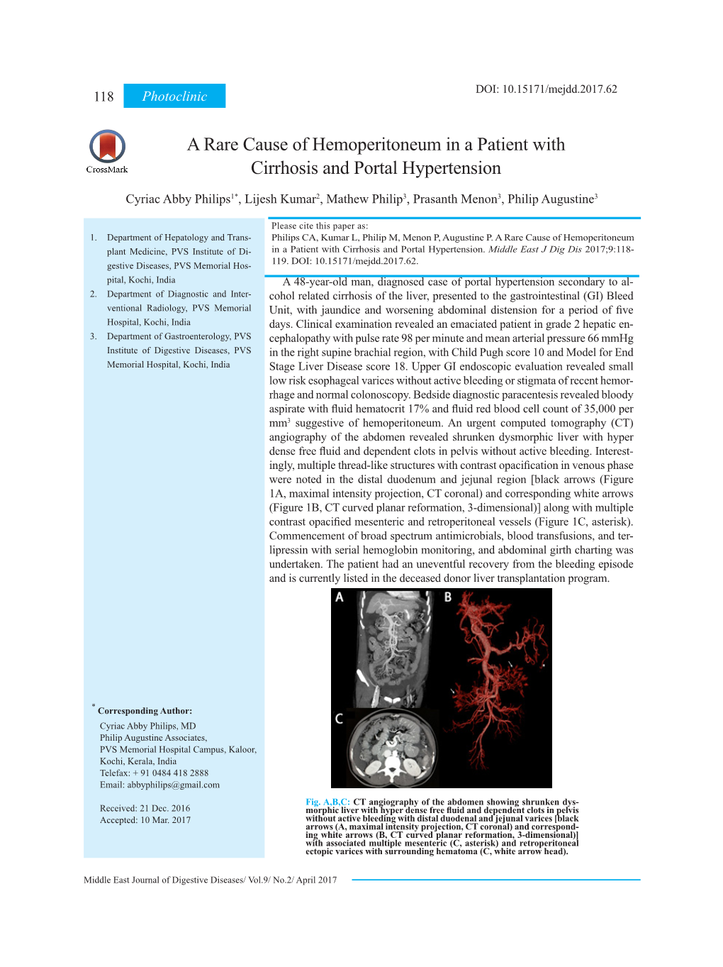 A Rare Cause of Hemoperitoneum in a Patient with Cirrhosis and Portal Hypertension