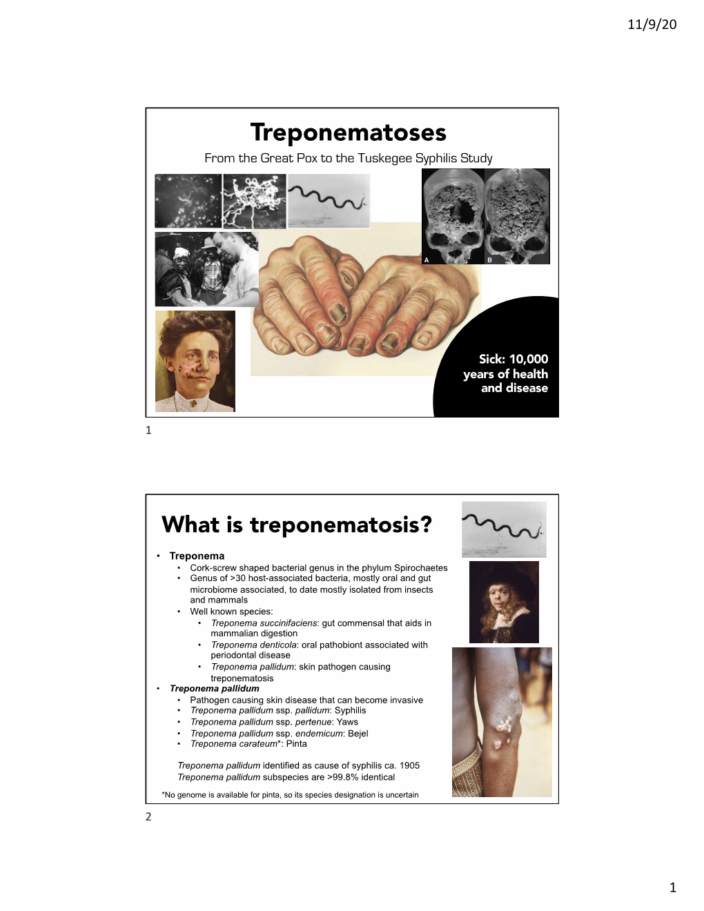 Treponematoses from the Great Pox to the Tuskegee Syphilis Study