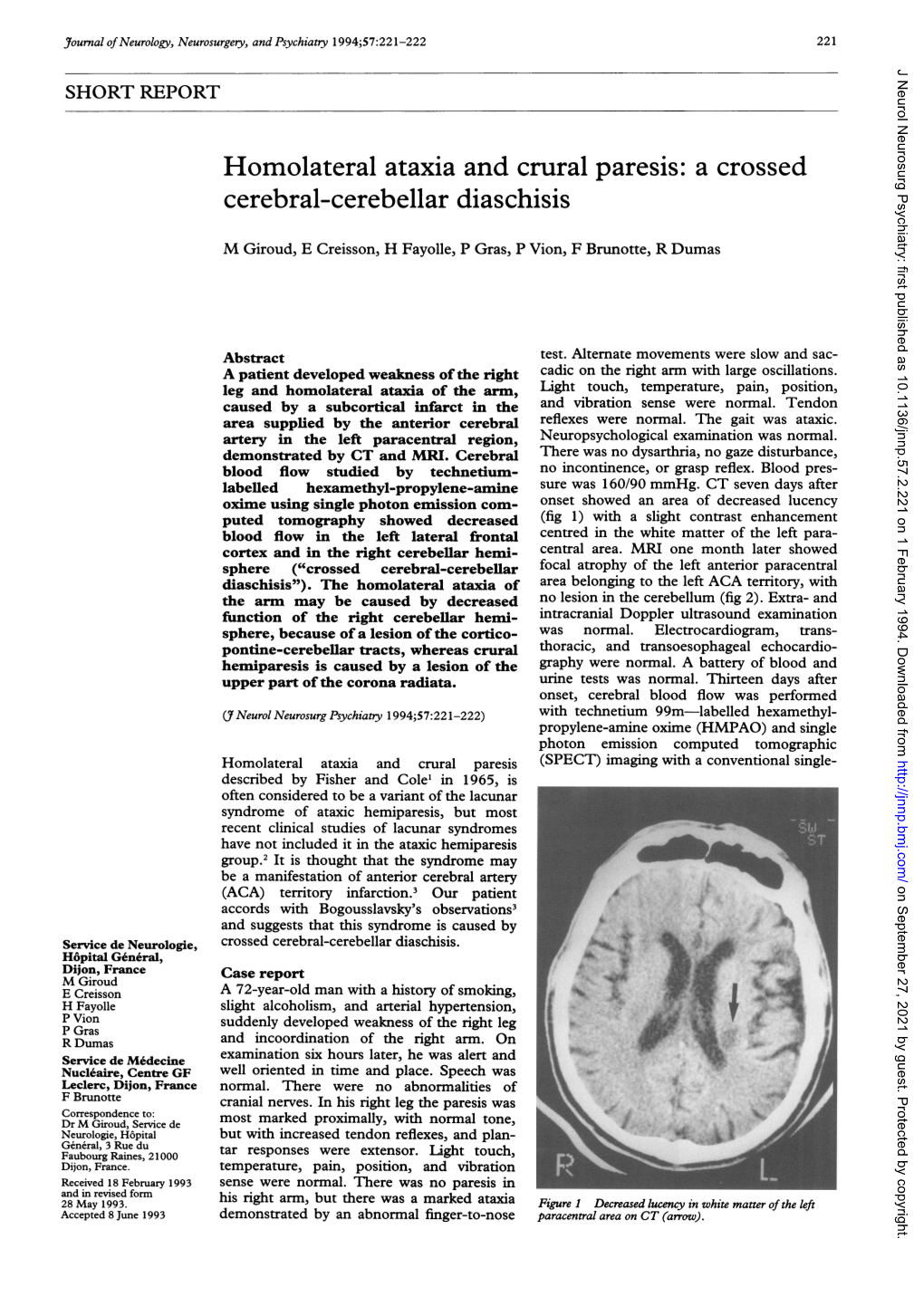 A Crossed Cerebral-Cerebellar Diaschisis