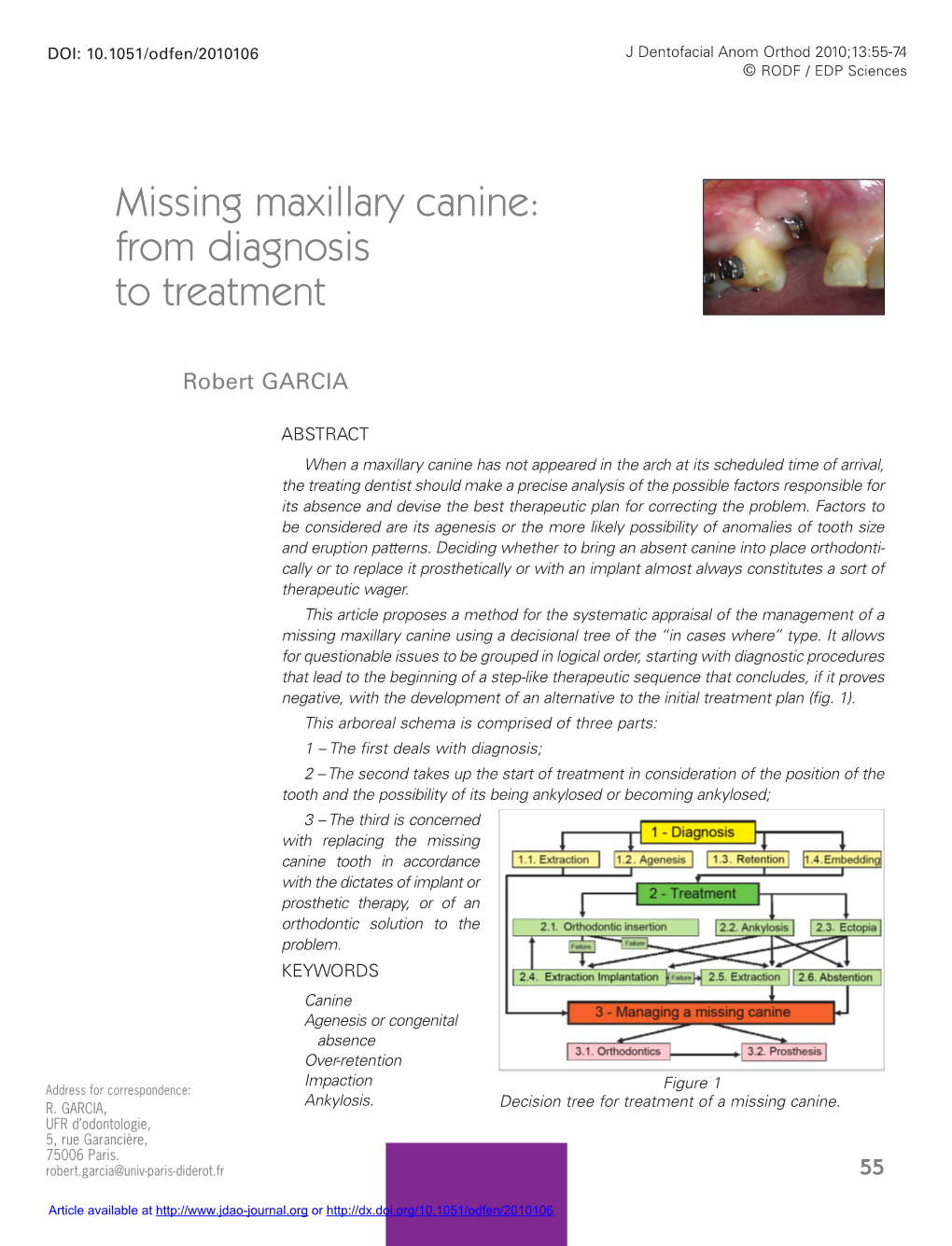 Missing Maxillary Canine: from Diagnosis to Treatment