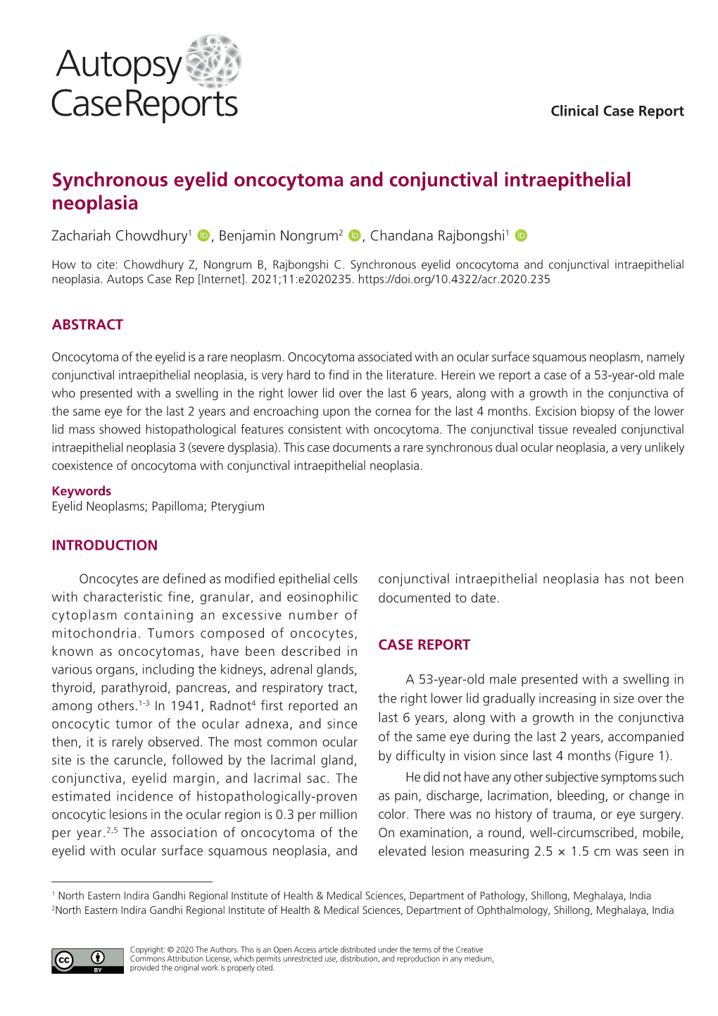 Synchronous Eyelid Oncocytoma and Conjunctival Intraepithelial Neoplasia