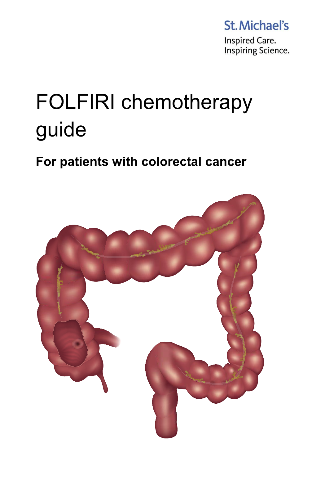 FOLFIRI Chemotherapy Guide