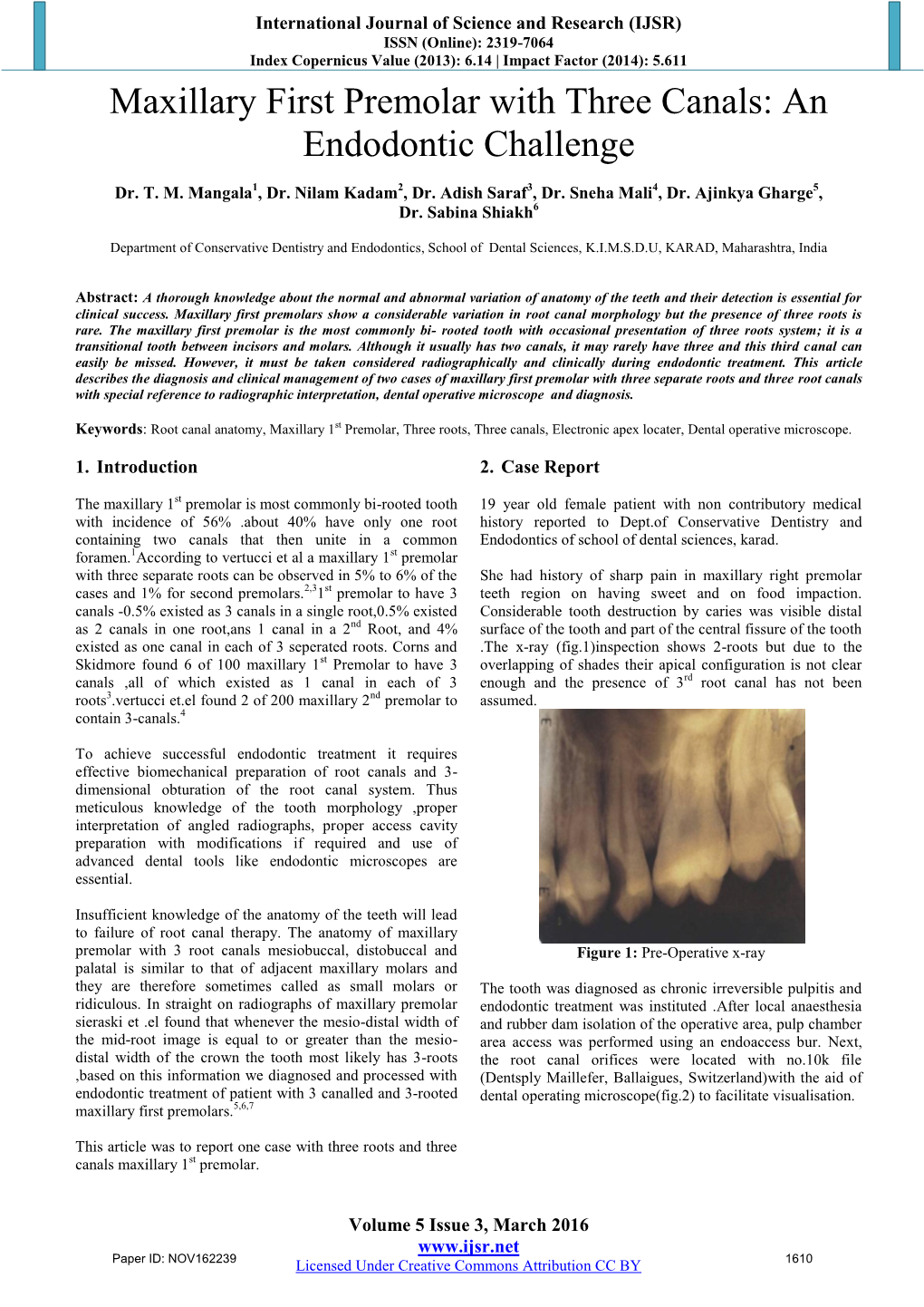 Maxillary First Premolar with Three Canals: an Endodontic Challenge