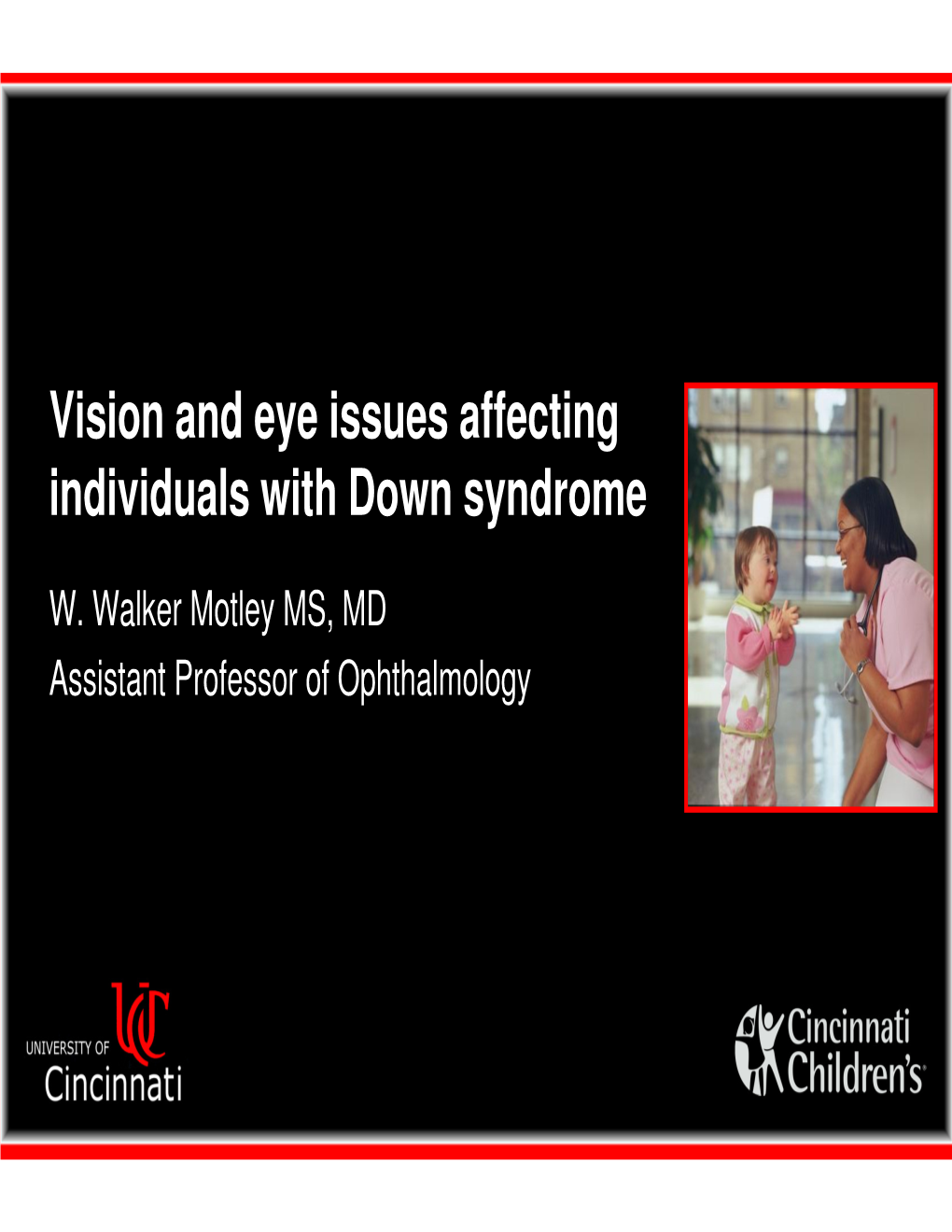 Vision and Eye Issues Affecting Individuals with Down Syndrome