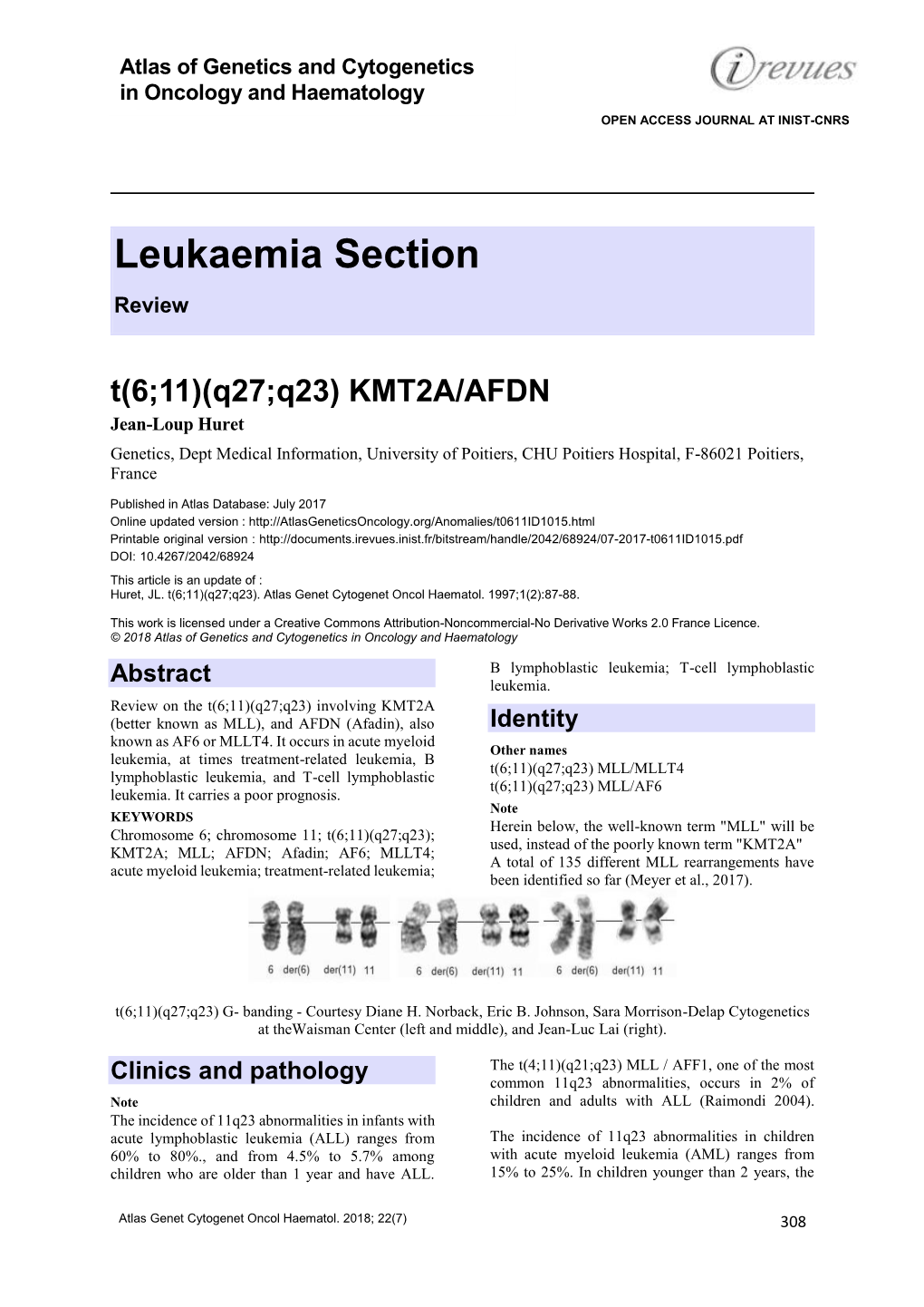 KMT2A/AFDN Jean-Loup Huret Genetics, Dept Medical Information, University of Poitiers, CHU Poitiers Hospital, F-86021 Poitiers, France