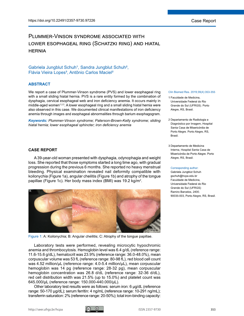 Plummer-Vinson Syndrome Associated with Lower Esophageal Ring (Schatzki Ring) and Hiatal Hernia