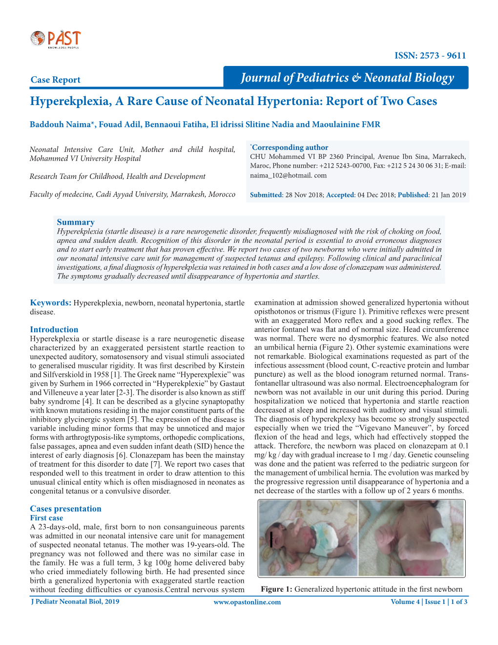 Hyperekplexia, a Rare Cause of Neonatal Hypertonia: Report of Two Cases