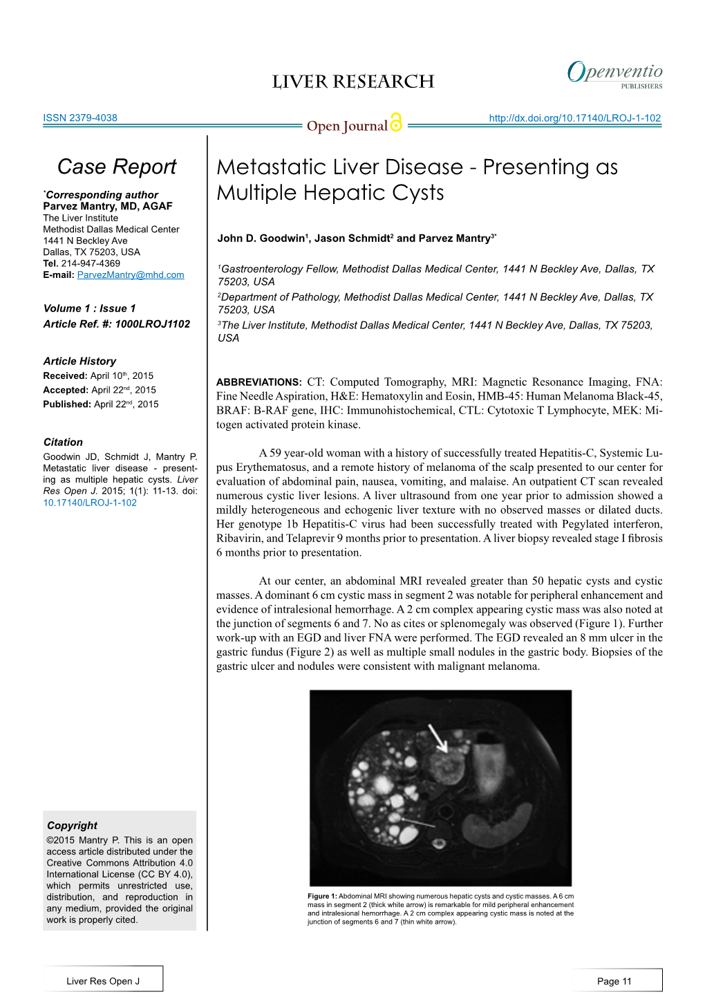 Metastatic Liver Disease