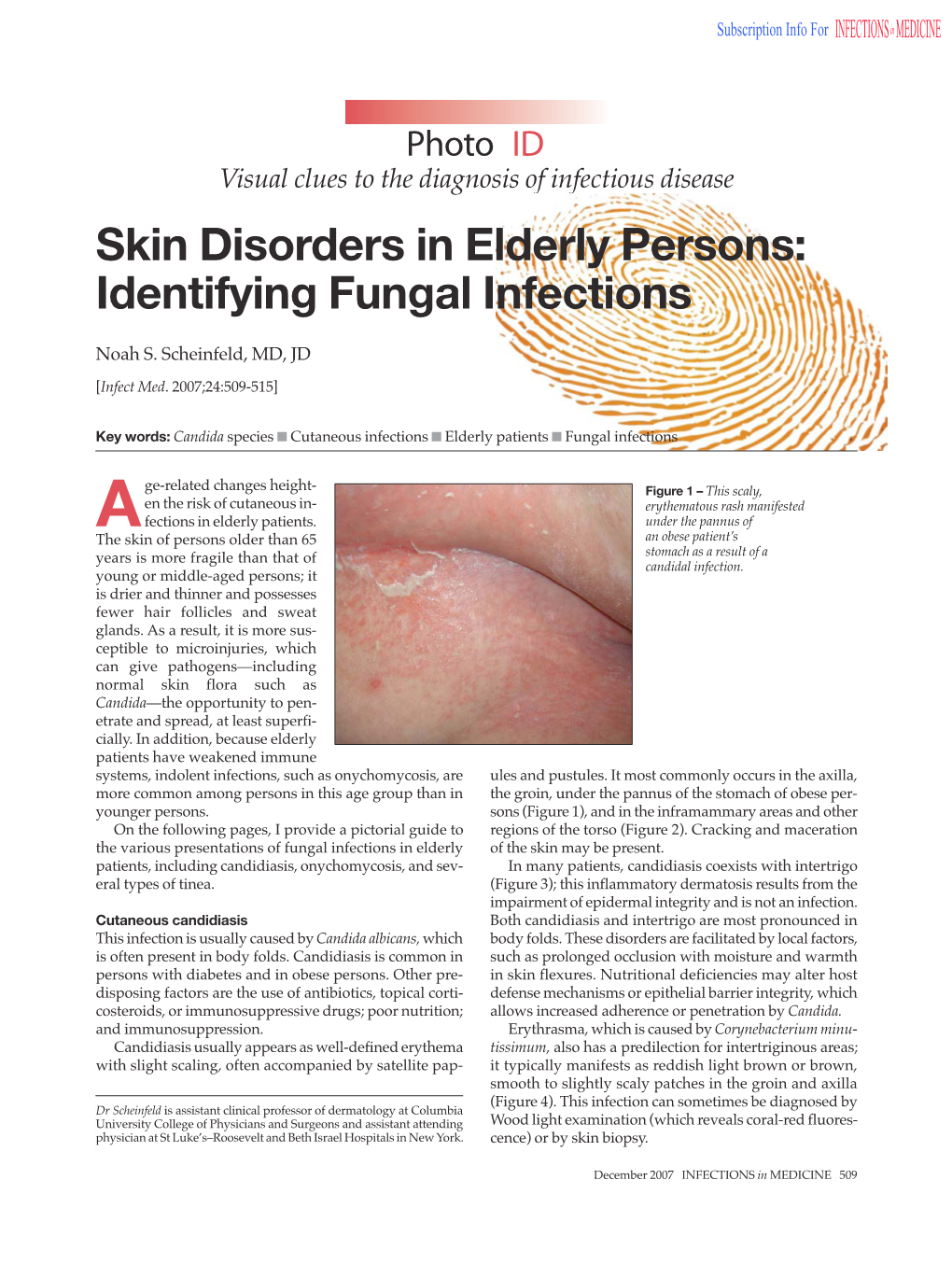 Skin Disorders in Elderly Persons: Identifying Fungal Infections