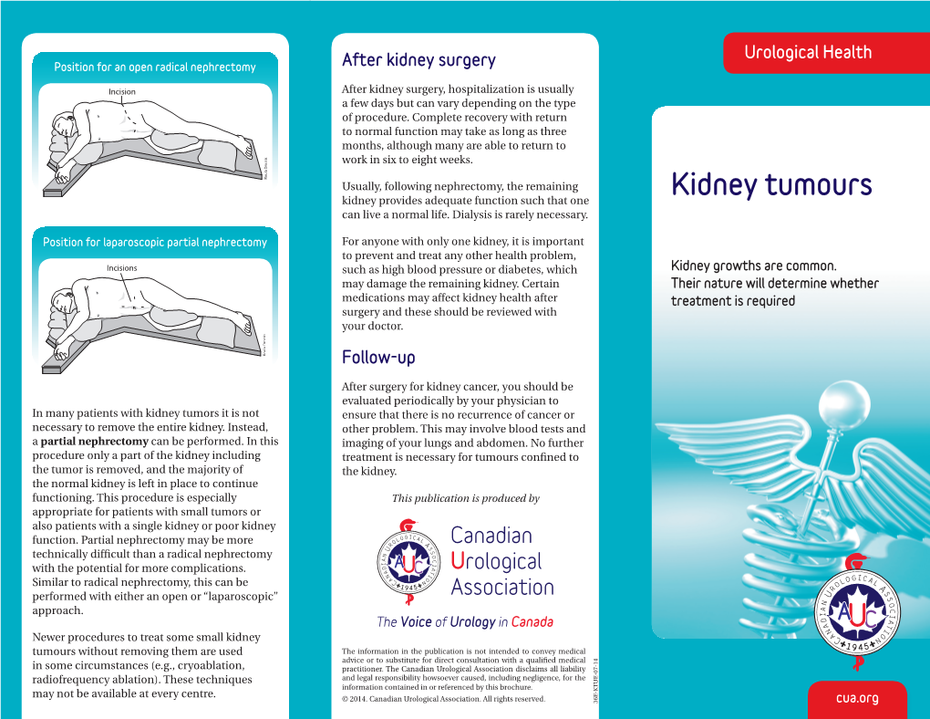 Kidney Tumours Can Live a Normal Life