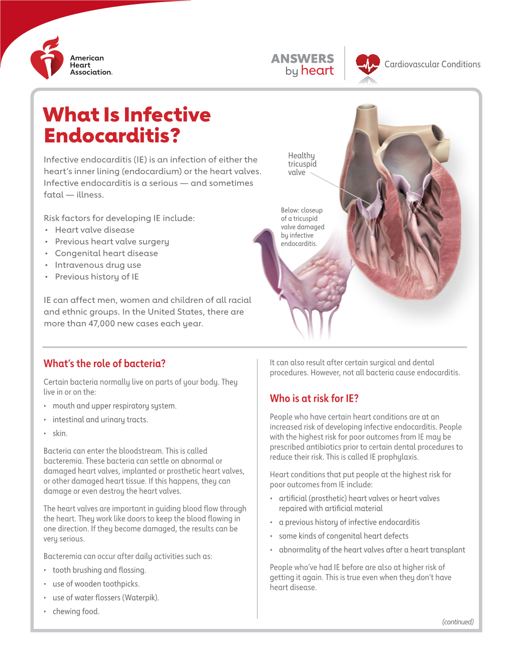 What Is Infective Endocarditis? Healthy Infective Endocarditis (IE) Is an Infection of Either the Tricuspid Heart’S Inner Lining (Endocardium) Or the Heart Valves