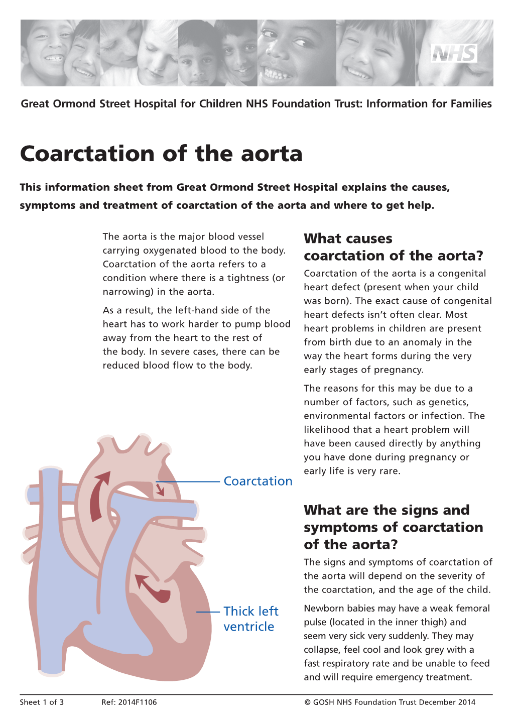 Coarctation of the Aorta