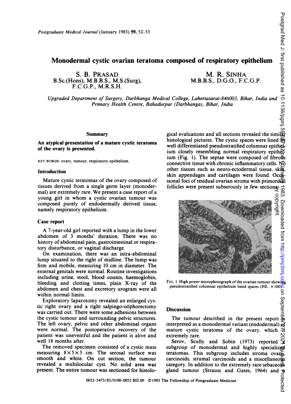 Monodermal Cystic Ovarian Teratoma Composed of Respiratory Epithelium S ...