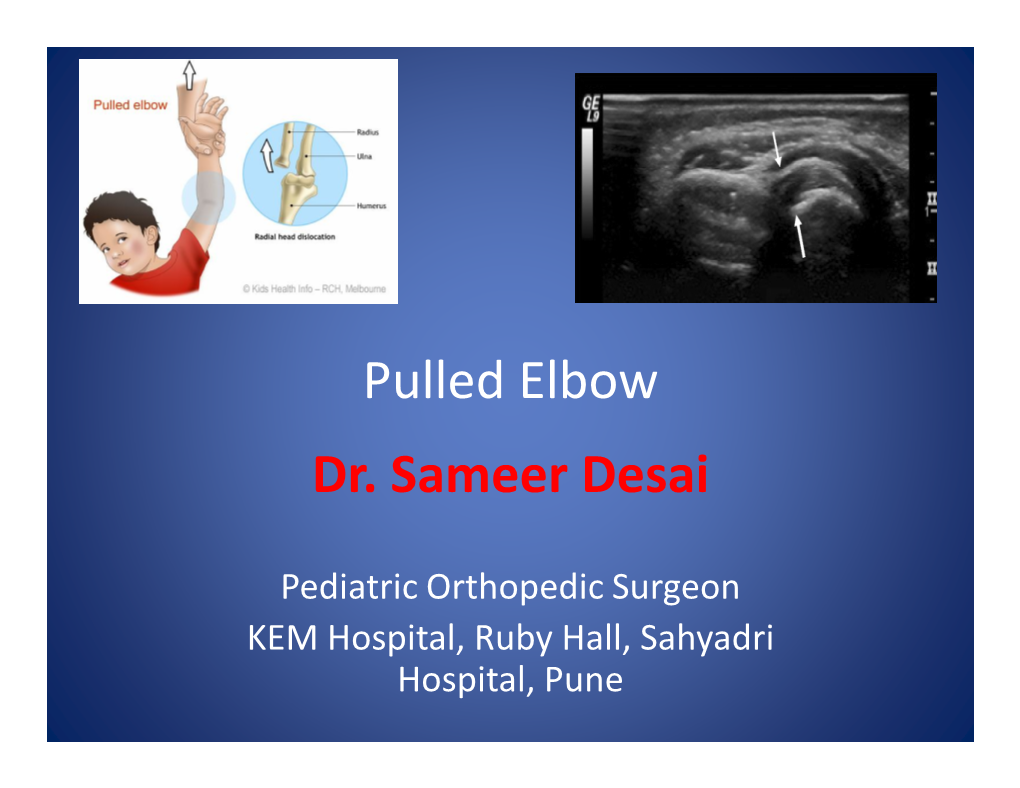Pulled Elbow Dr. Sameer Desai