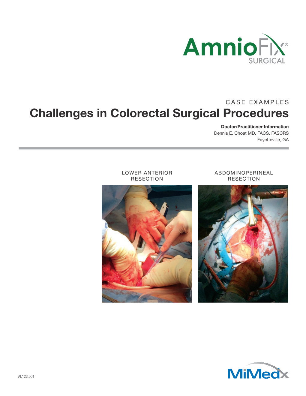 Challenges in Colorectal Surgical Procedures