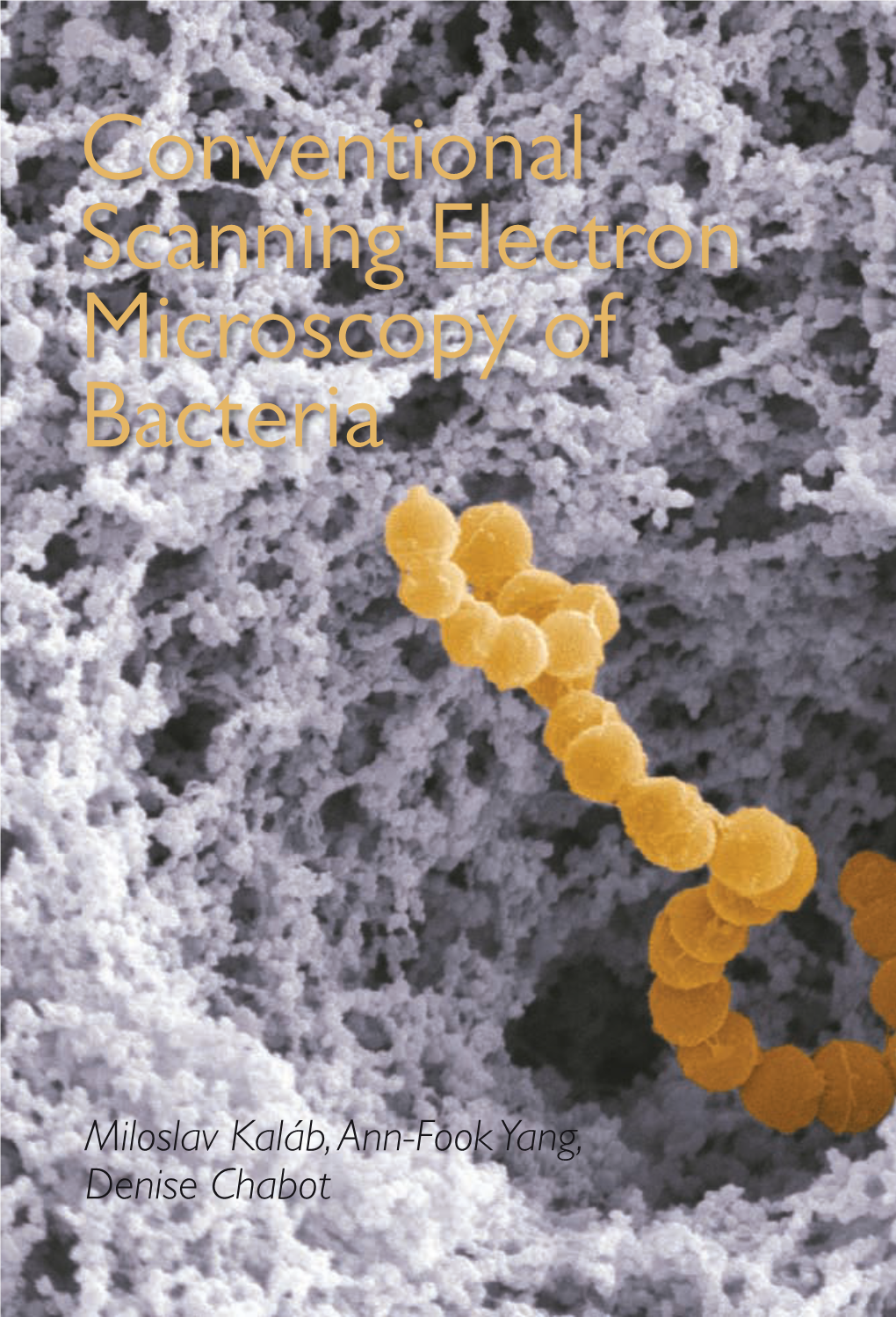 Conventional Scanning Electron Microscopy of Bacteria